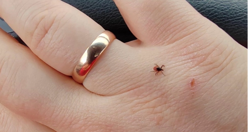 Осторожно, клещ: Роспотребнадзор предупредил жителей Кировской области о росте числа укусов