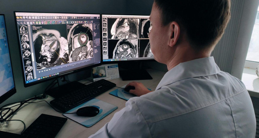 В Кировской области с помощью ИИ обработали более 28 миллионов медицинских случаев