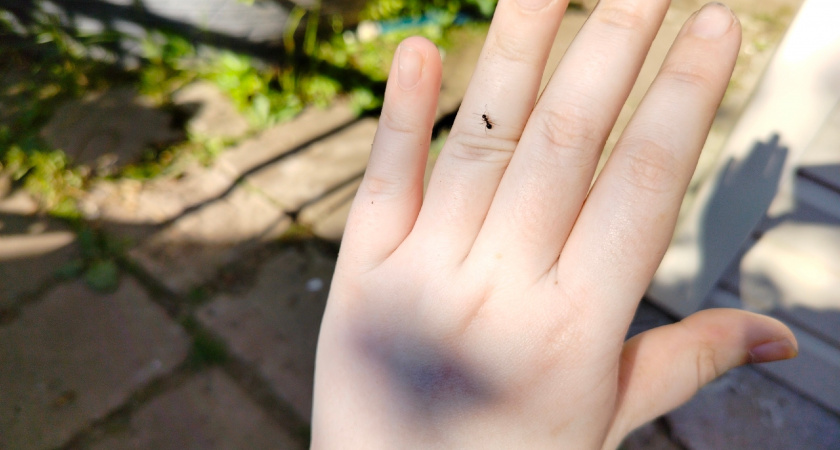 Уксус, зола и горчица против муравьёв: что действительно эффективно на даче