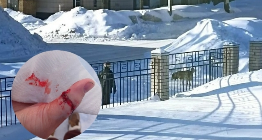 "Сыну предстоит 3 месяца колоться от бешенства": в Чепецке агрессивный пес искусал ребенка у школы