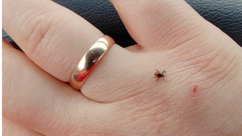 Почему в СССР клещей не было, а сейчас они нападают даже в городских парках 