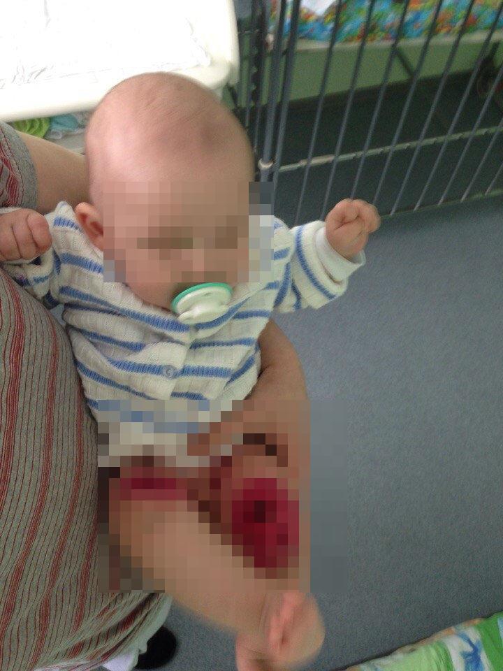 Полугодовалый ребенок два дня провел в одной квартире с трупом матери