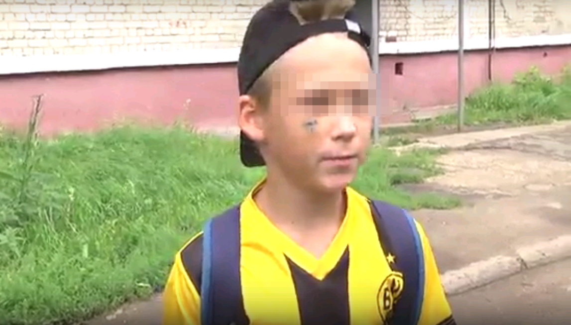 В Чепецке огромный пес укусил 10-летнего ребенка в лицо