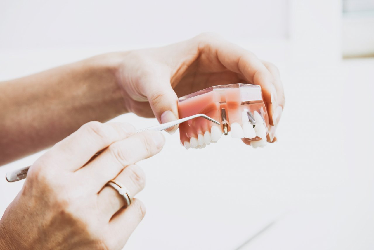 Дорогая услуга в кирово-чепецкой стоматологии рекордно подешевела