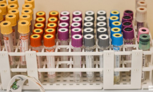 Кировская студентка нашла способ лечить рак дешевле