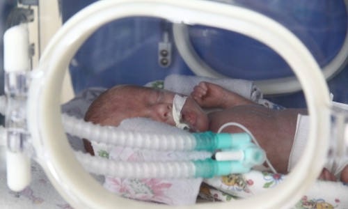 В Кировской области уникальное событие: родилась четверня