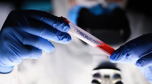 100 человек заразились коронавирусом за сутки в Кировской области 