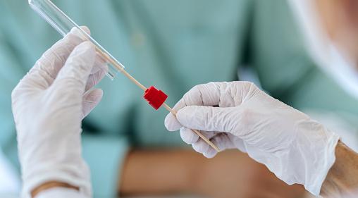 Минздрав опубликовал суточную статистику заболеваемости COVID-19 в Кировской области 