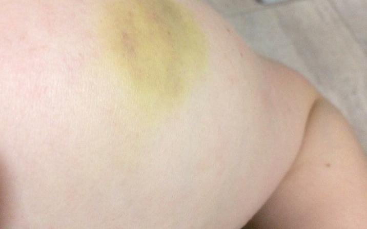 Девушка пострадала на аттракционе у цирка в Кирове