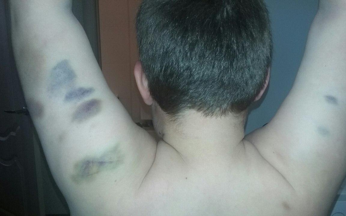 В детском лагере в Кировской области избили школьника