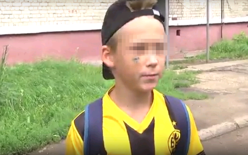 В Чепецке огромный пес укусил 10-летнего ребенка в лицо