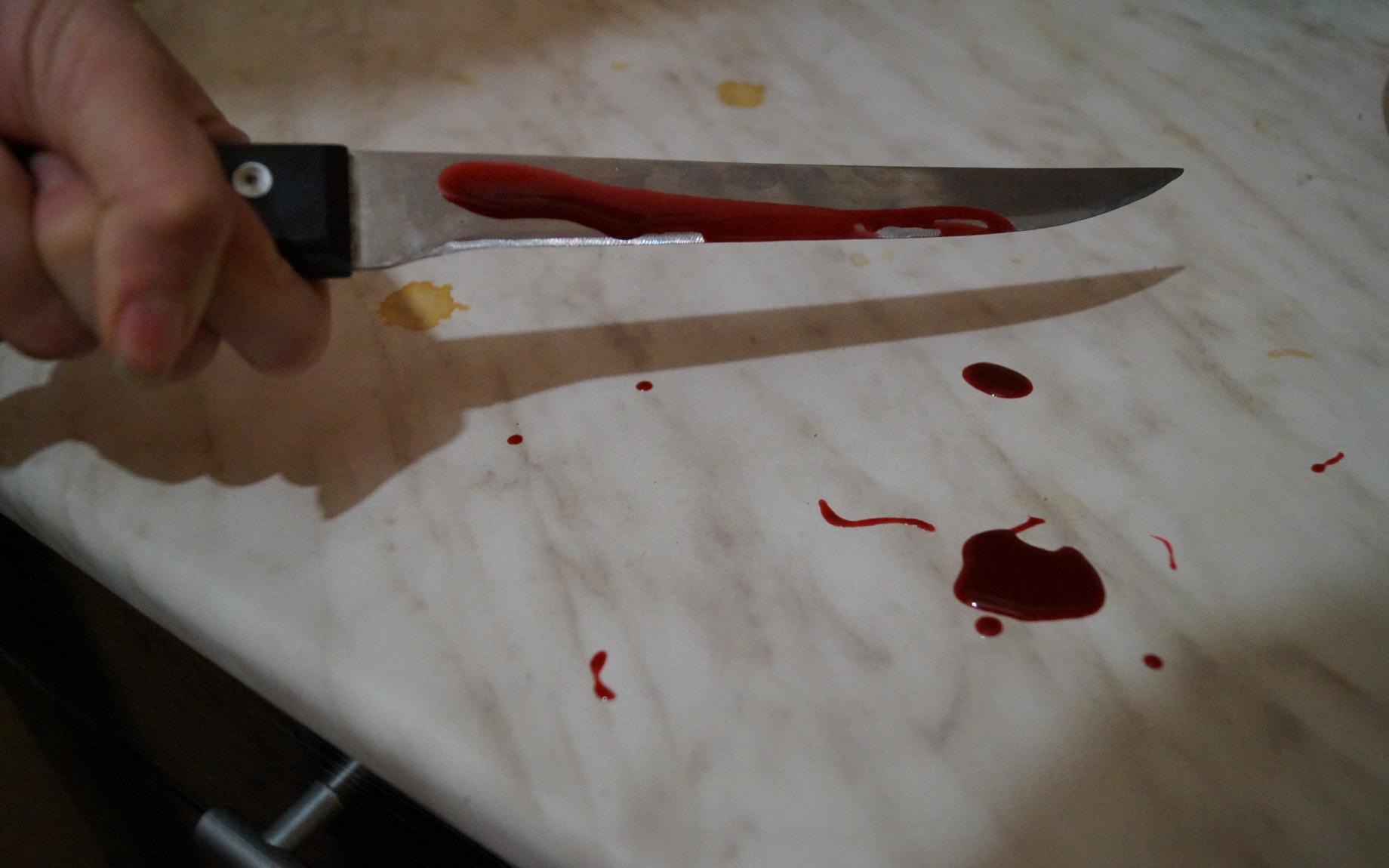 В Чепецке мужчина воткнул нож в горло своего отца