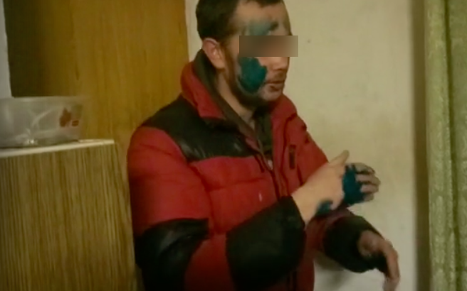 В Кирове мужчину, не заплатившего за такси, заставили умыться зеленкой