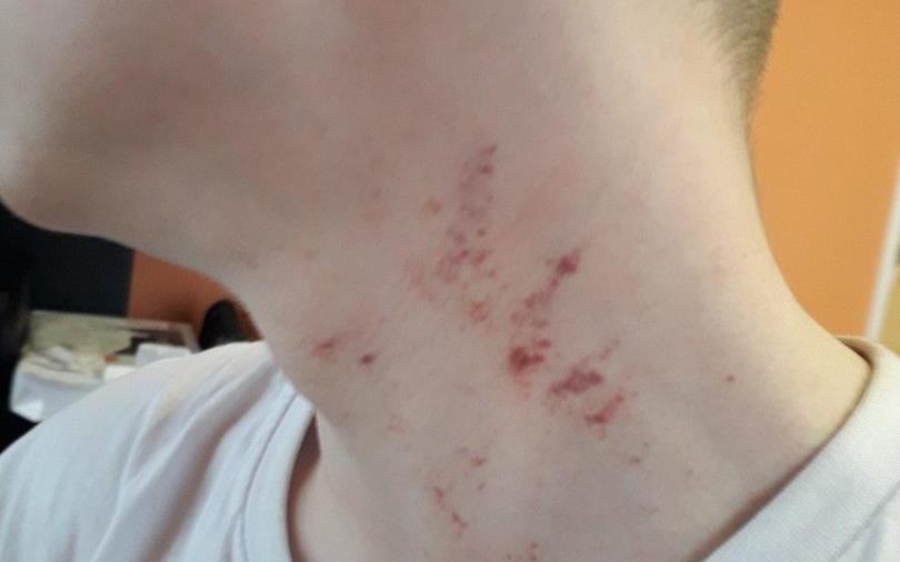 В Чепецке на улице Горького сотрудник колонии избил подростка