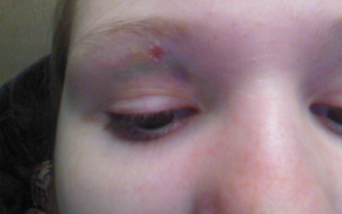 В Кировской области малолетние хулиганы закидали камнями девочку на улице