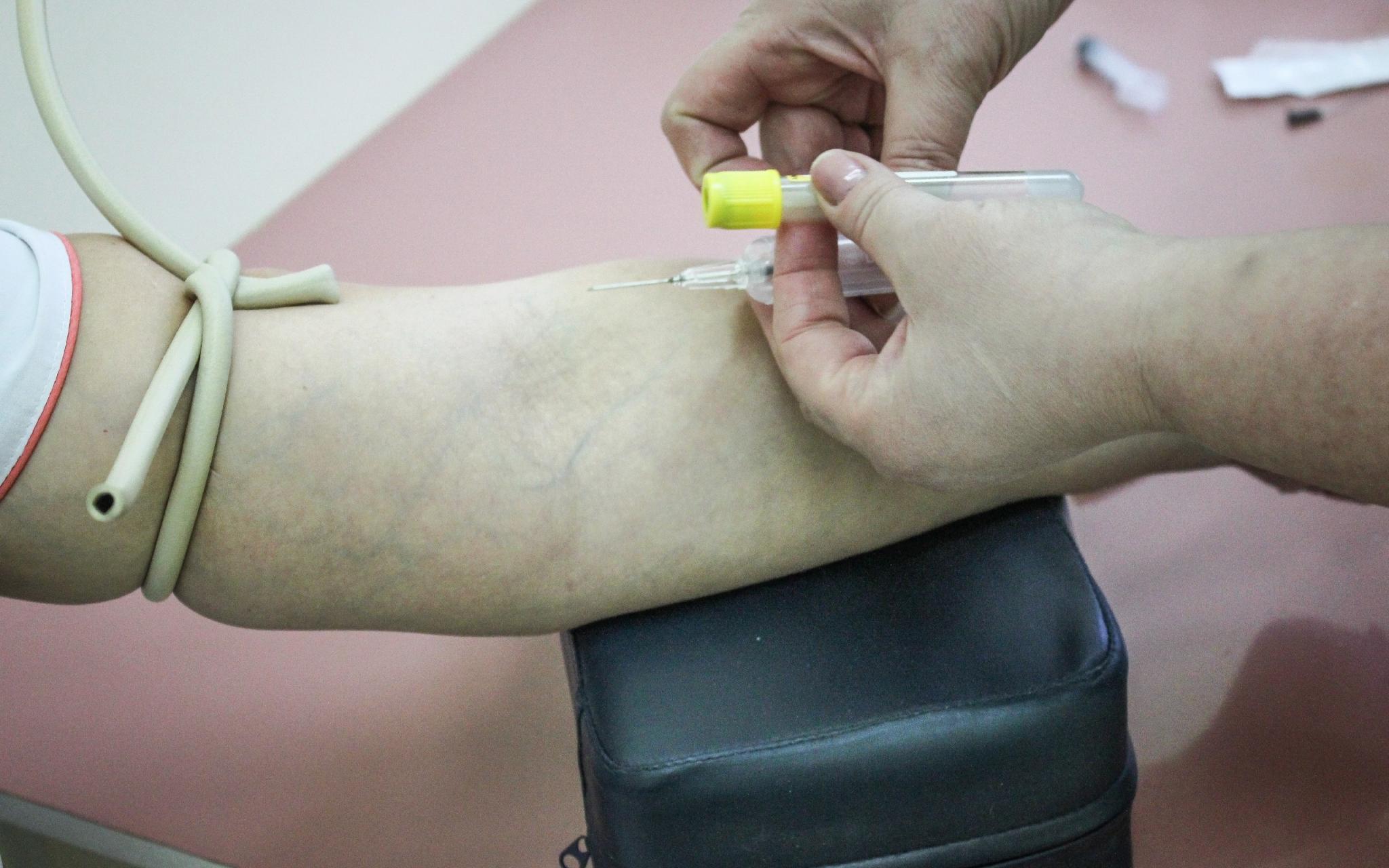 Чепчане могут сдать бесплатный тест на ВИЧ