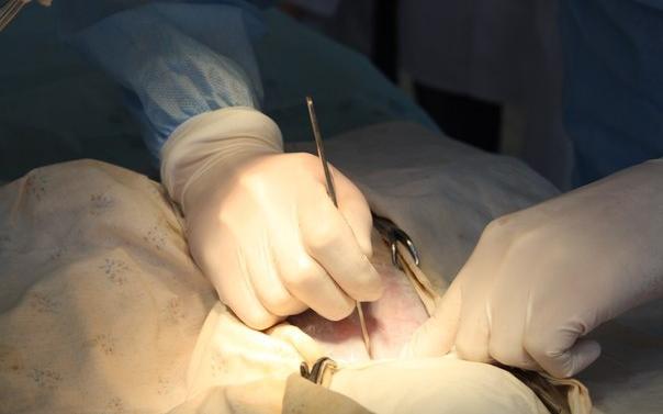 Чепчанину после переохлаждения в своей квартире ампутируют палец