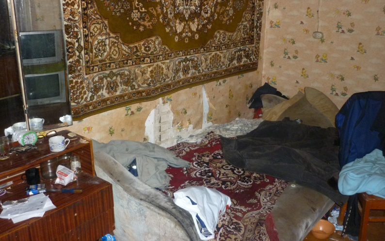 Чепчанину ампутируют палец из-за переохлаждения: в УК прокомментировали ситуацию