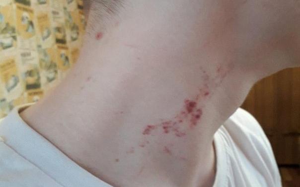 В Чепецке вынесли приговор сотруднику колонии, избившему подростка