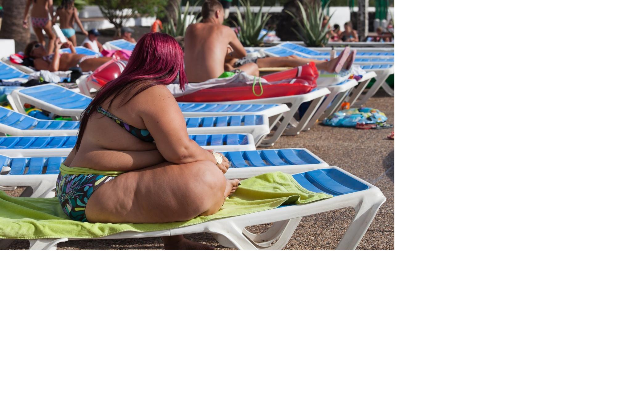 В Кировской области выросло число людей, страдающих ожирением