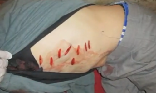 В Слободском «труп» ожил и бросился на эксперта-криминалиста (ВИДЕО)