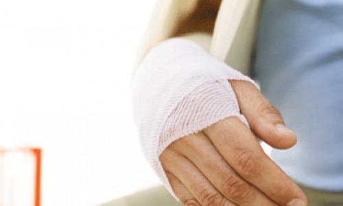 Чепчанин сломал палец однокласснику своей дочери