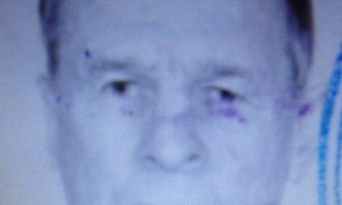 В Кировской области 80-летний мужчина ушел на прогулку и не вернулся