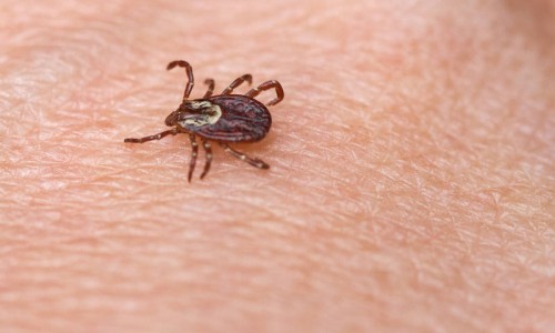 Кирово-Чепецк находится на втором месте в области по количеству пострадавших от укусов клещей