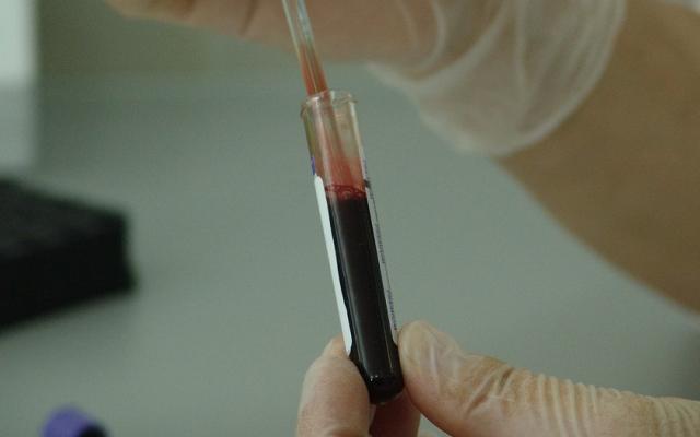 Известно, сколько новых ВИЧ-инфицированных появилось в Кирово-Чепецке