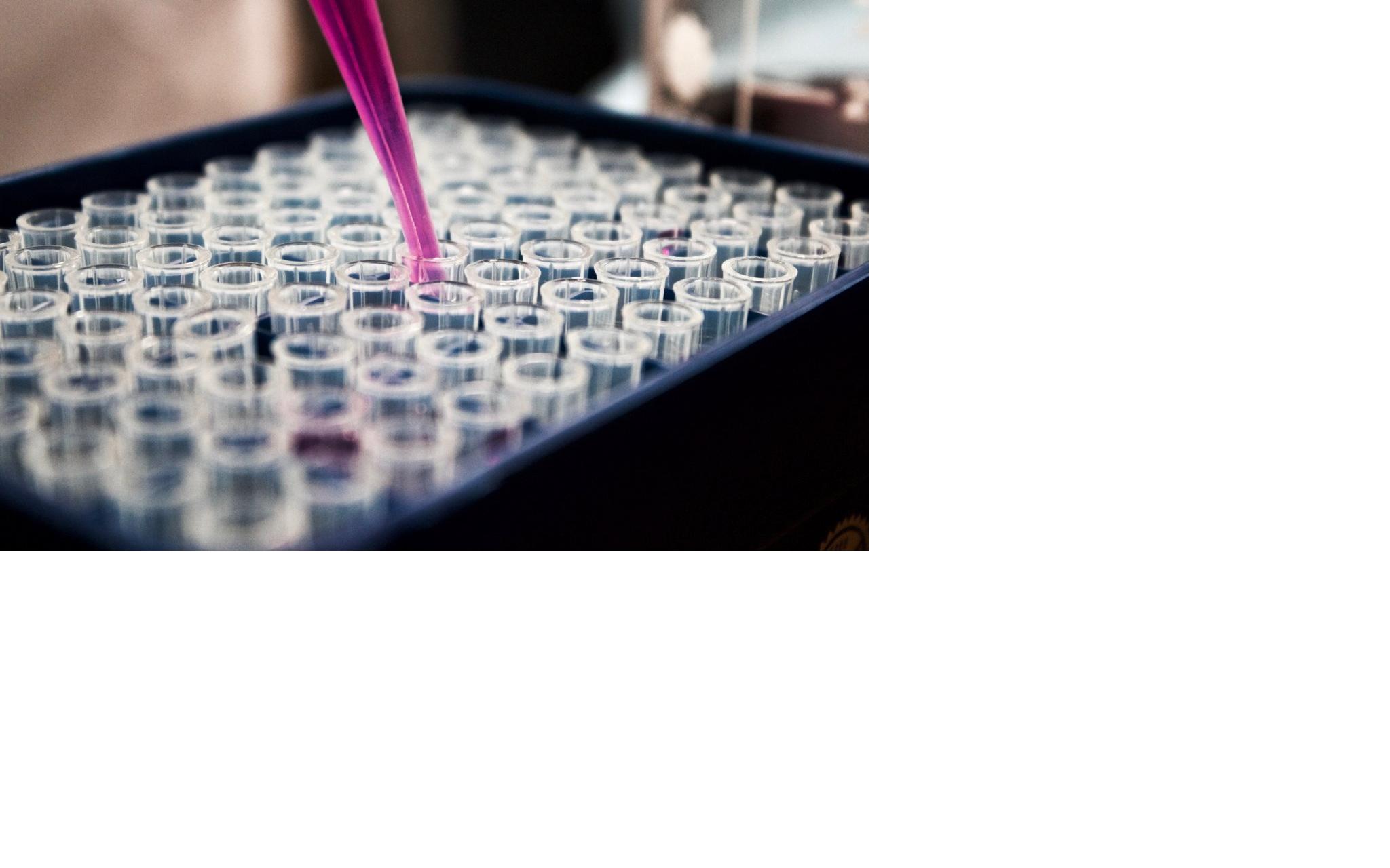 Специалисты назвали группу крови, наименее уязвимую к COVID-19