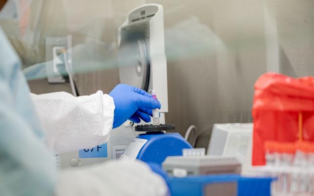 В Кировской области зарегистрировано 62 новых случая COVID-19 за сутки