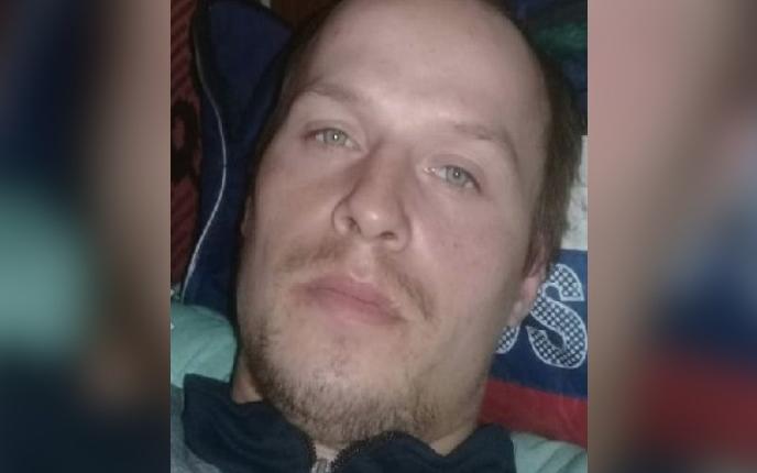 26-летнего мужчину с ожогом разыскивают в Кировской области