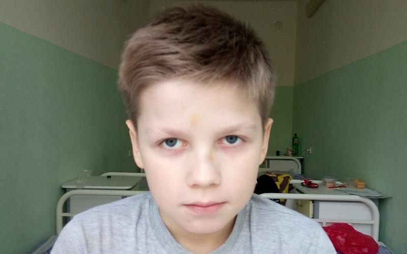 В Кирово-Чепецке подростки жестоко избили 9-летнего мальчика за отказ дать им денег