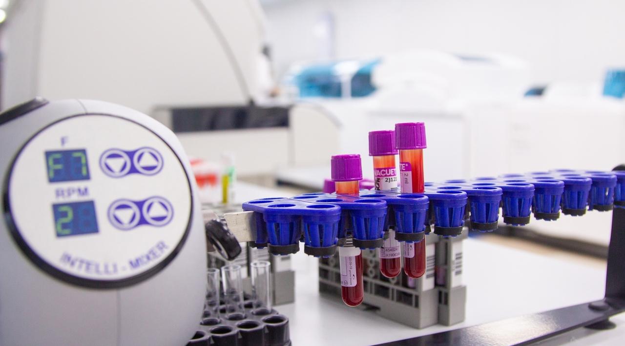 В Кировской области зафиксировали снижение роста заболеваемости COVID-19