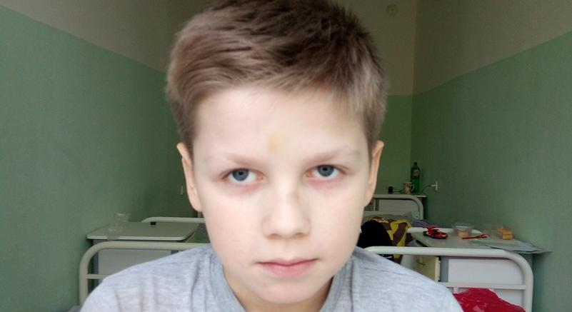 В Кирово-Чепецке подростки жестоко избили 9-летнего мальчика за отказ дать им денег