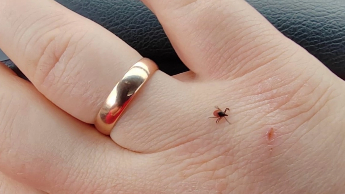 Почему в СССР клещей не было, а сейчас они нападают даже в городских парках 