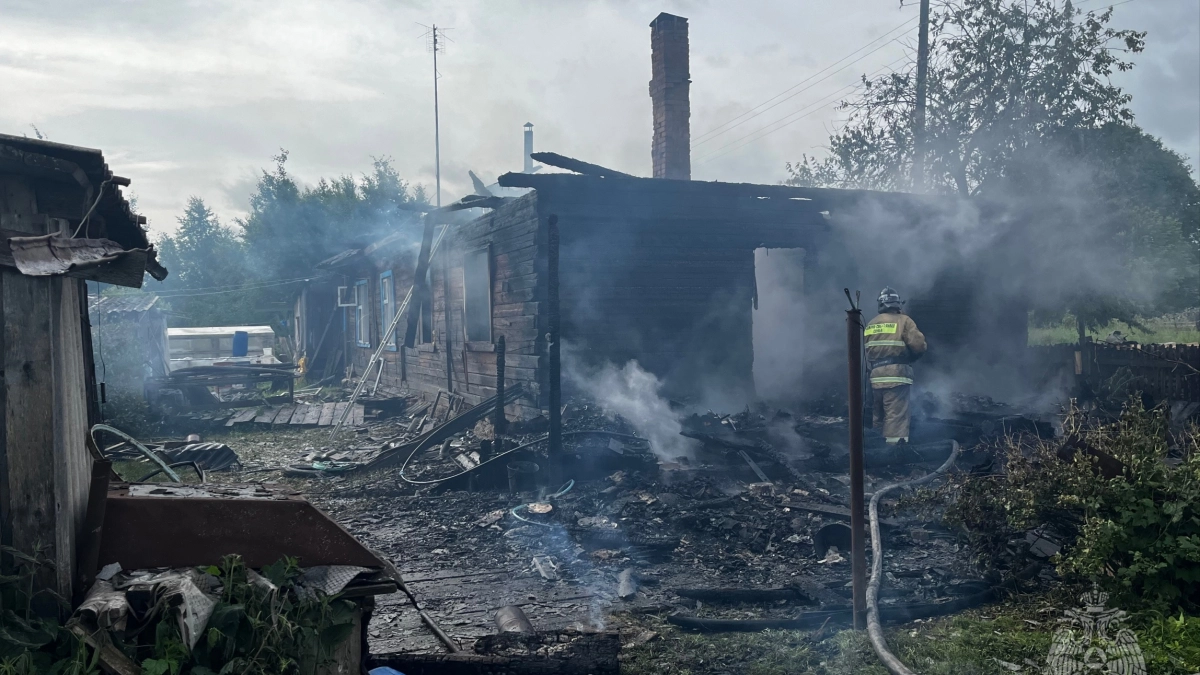 Пожар в Кировской области отправил хозяина дома в больницу с ожогами