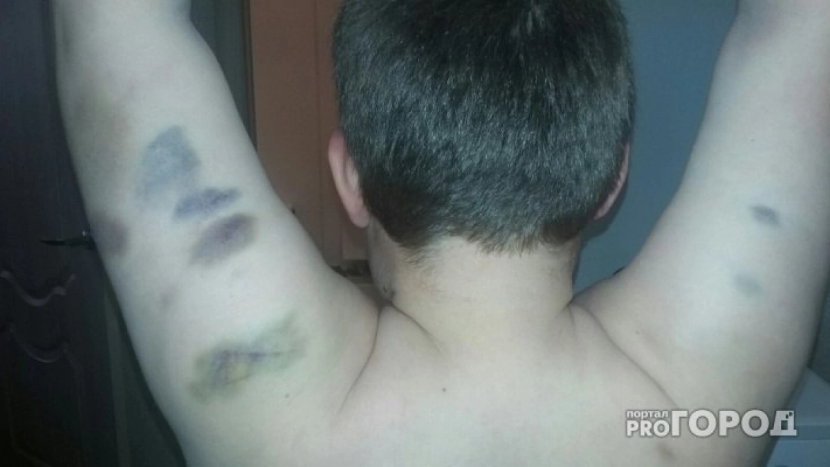 Один против троих: в Кирово-Чепецке подростки избили 12-летнего мальчика за попытку защитить девочку 